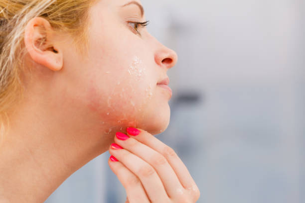Skin cleaners