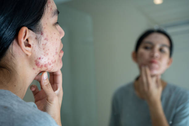 The Ordinary Niacinamide 10% + Zinc 1%: Why This $7 Serum Nearly Ruined My Skin (And How I Fixed It)