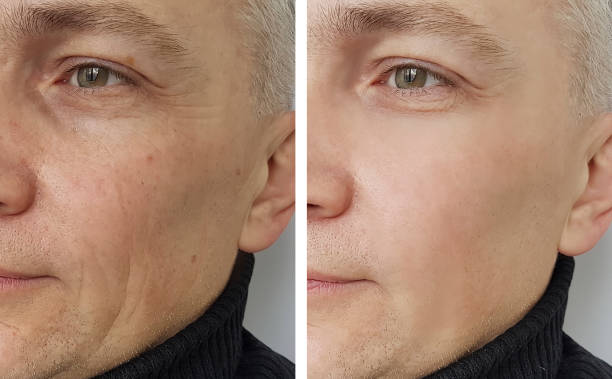 Niacinamide
