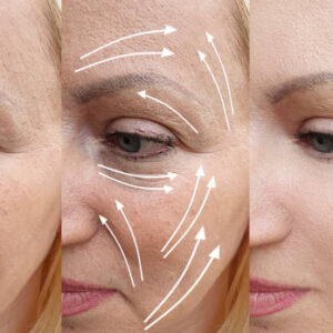 Anti-aging-supplements