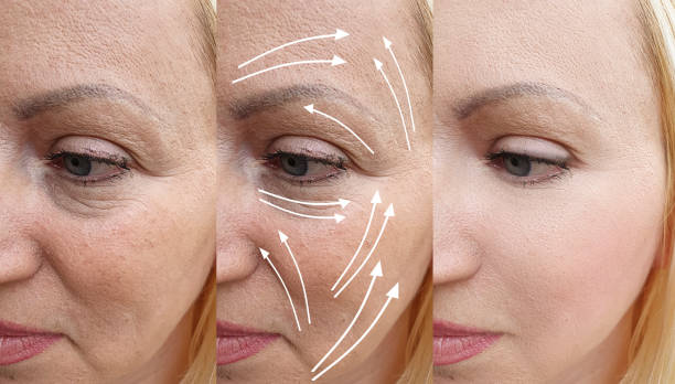 Anti-aging-supplements