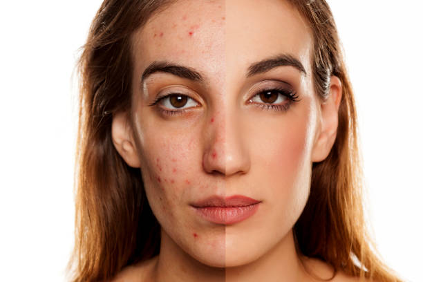 Darkspot removal kit